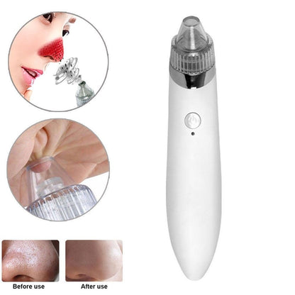blackhead extractor facial machine
